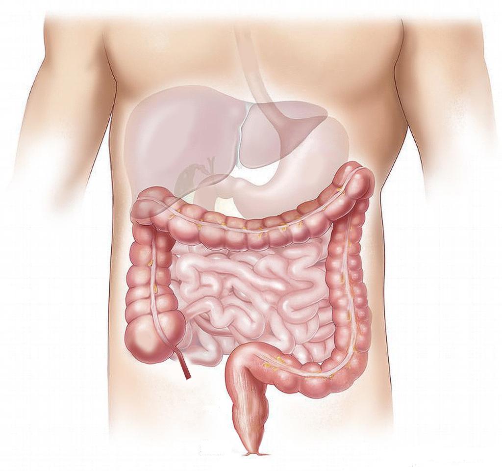 risk factors and prevention 10 tips for colorectal cancer