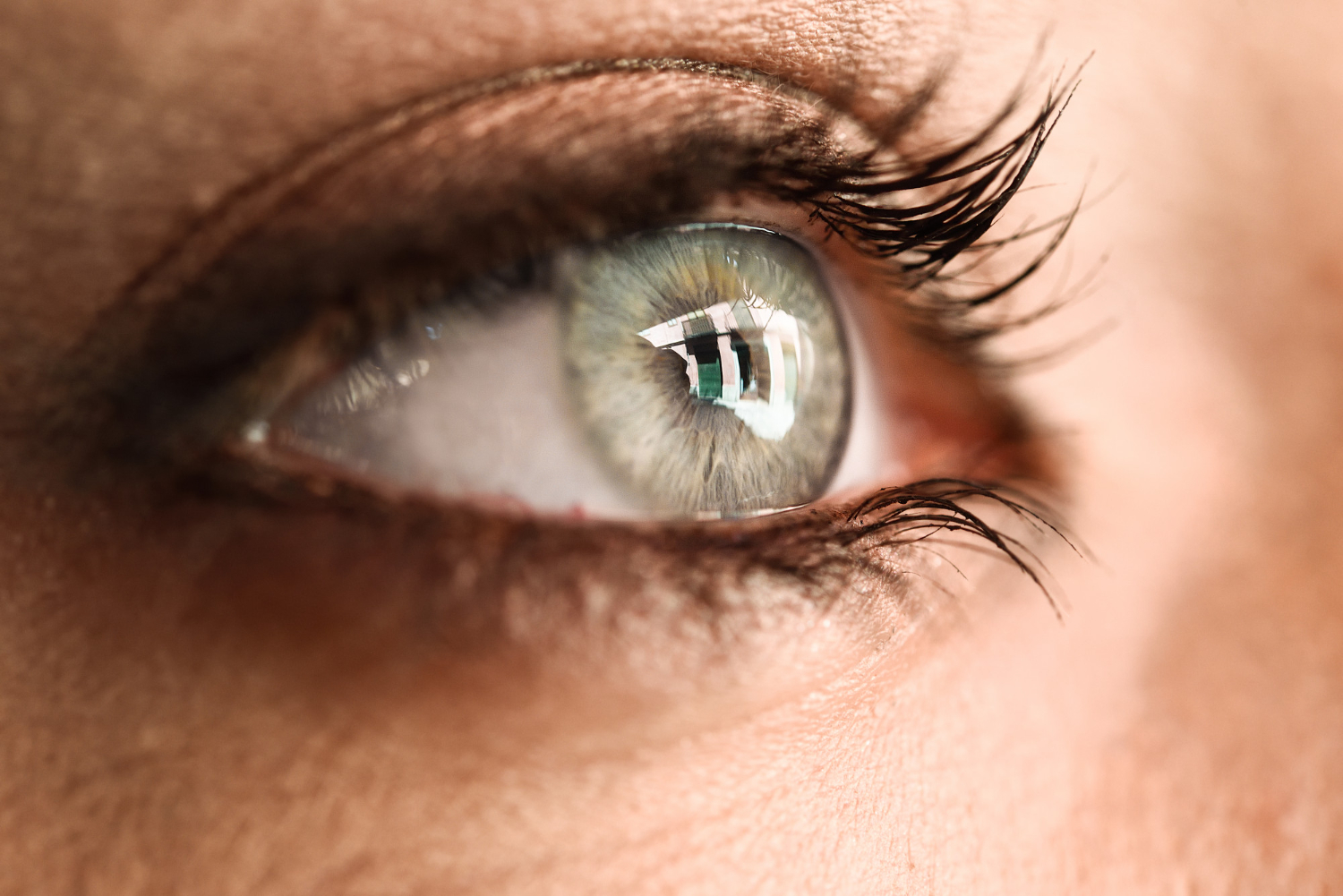 10 Best Remedies for Eye Allergy Relief