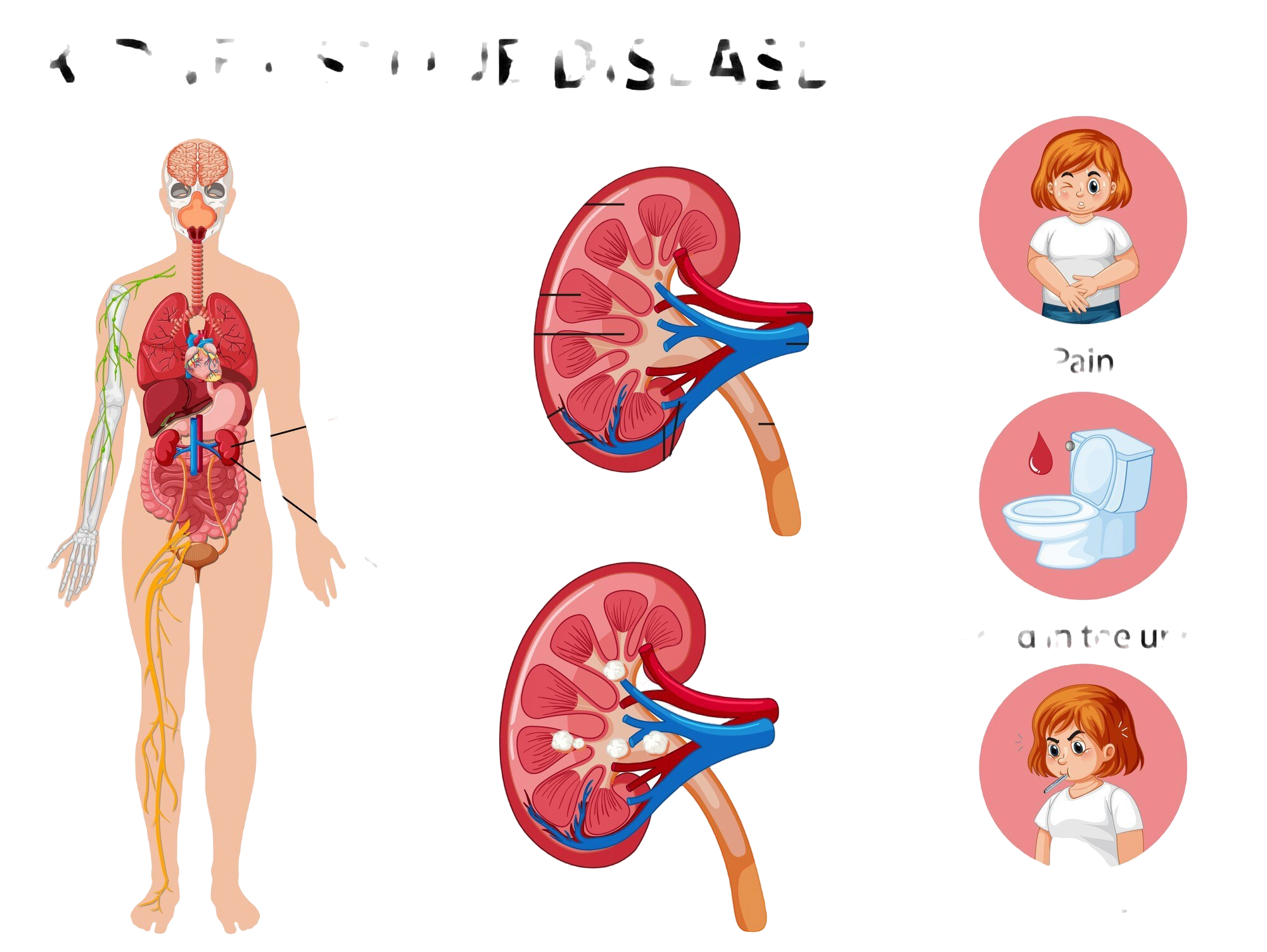 Top 8 Tips for Preventing Kidney Disease